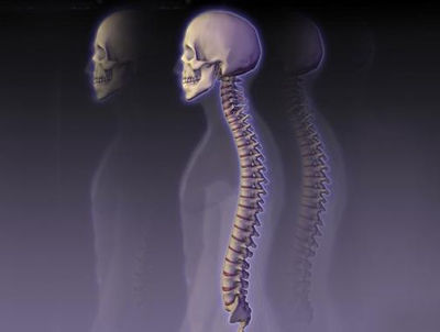 错误动作引发脊椎病 办公族如何保护脊椎